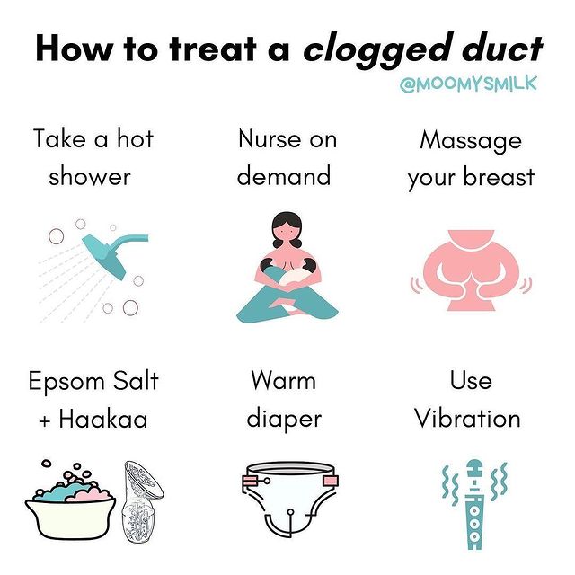 Breast pain, How to remove clogged duct? Susu tersumbat?